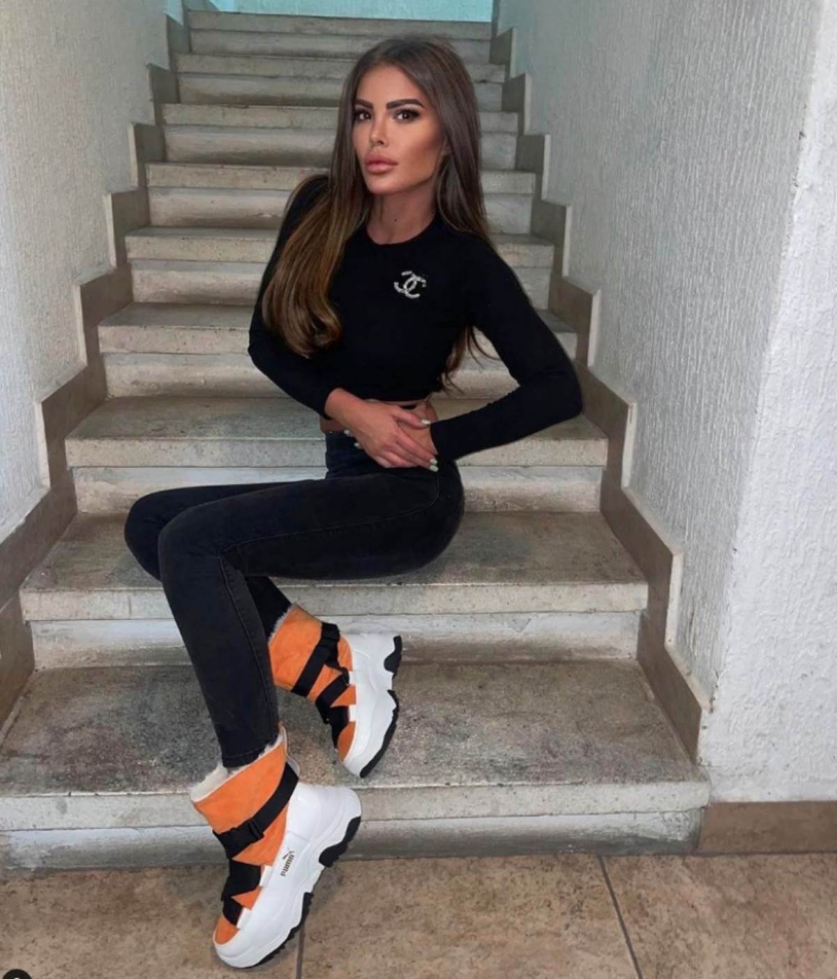 Dragani Mitar sekli rebro zbog operacije nosa