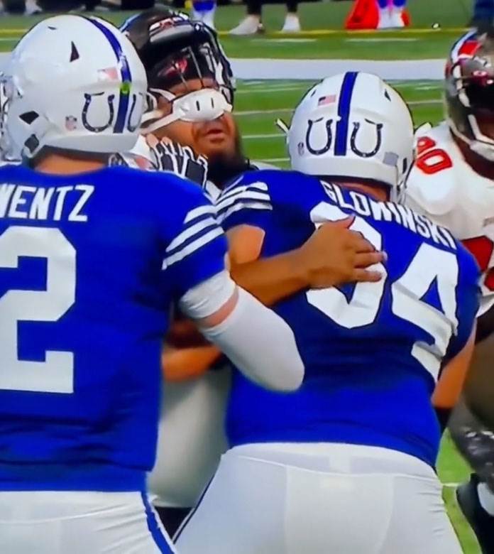 NFL igrač ostao bez zuba u duelu