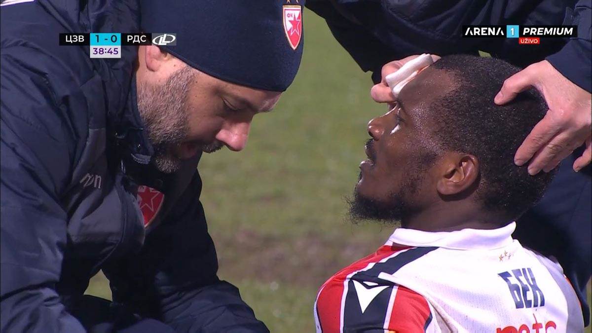 Ben, Povreda, Zvezda (6).jpg