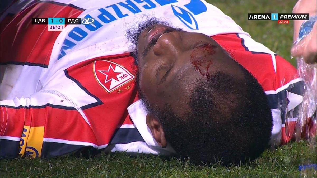 Ben, Povreda, Zvezda (7).jpg