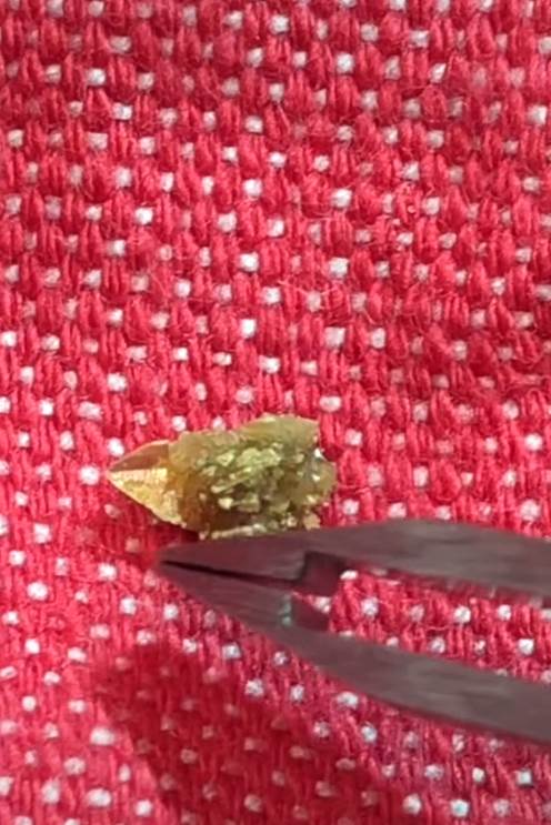 kamen u bubregu 6.png