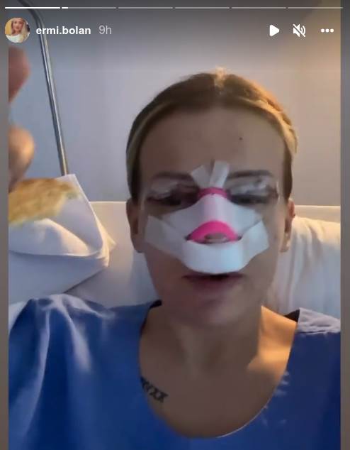 Erminu Pašović isprozivali zbog izgleda