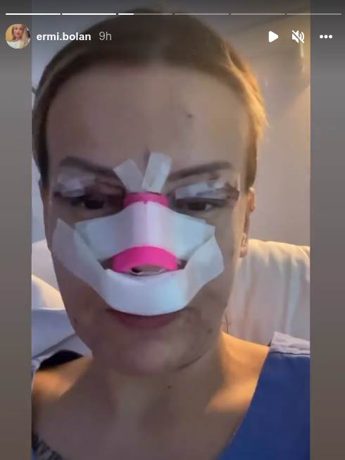 Ermina Pašović posle operacije