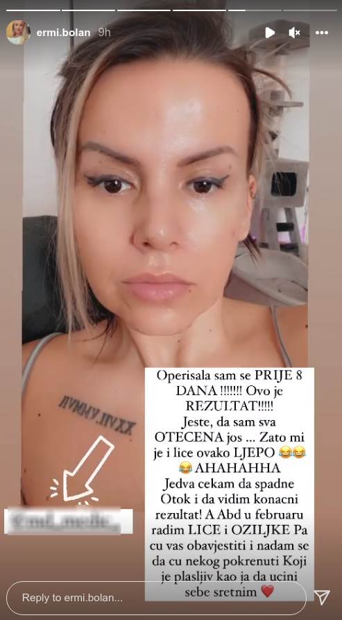 Erminu Pašović isprozivali zbog izgleda