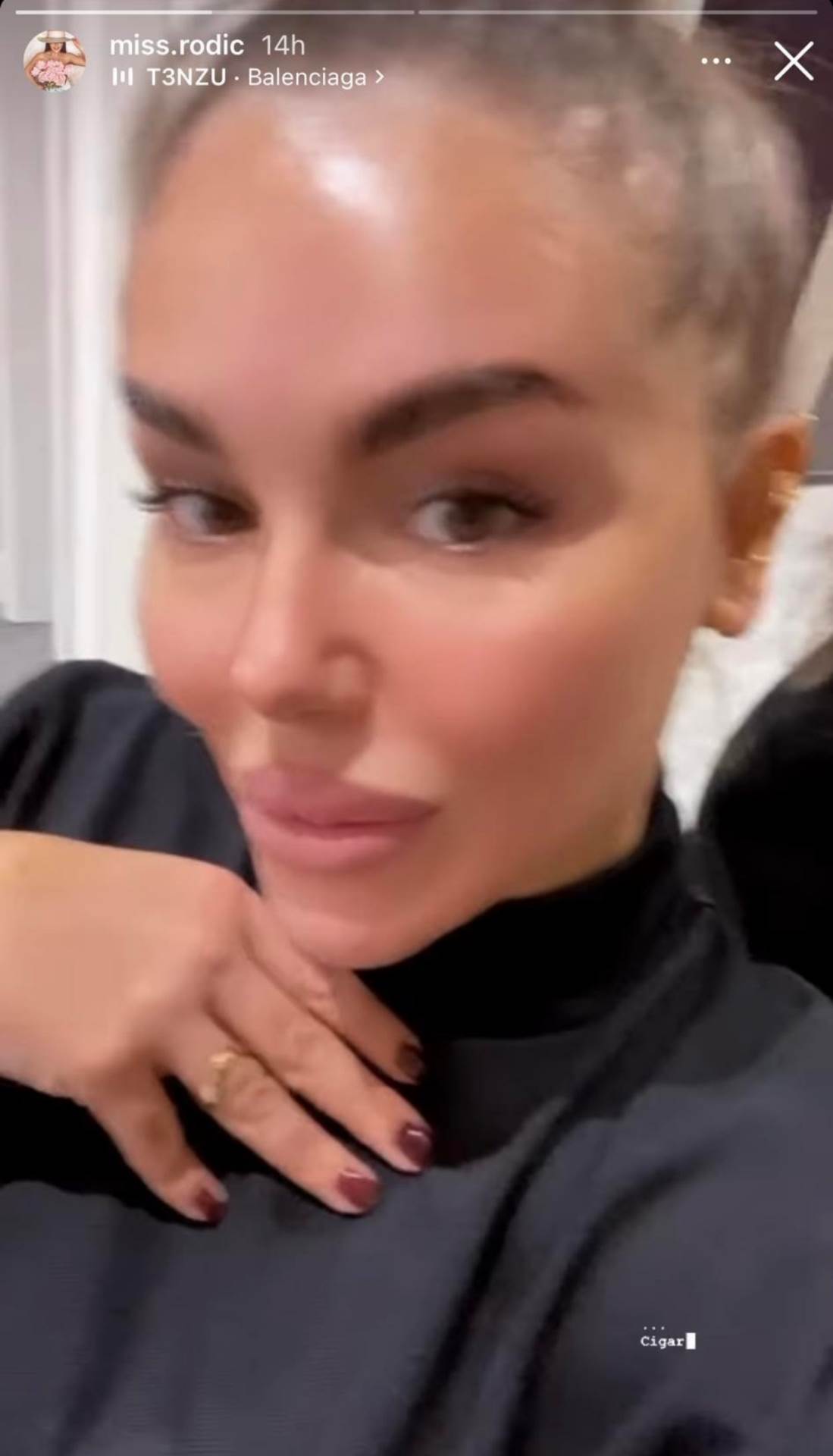 Nataša Rodić plastične operacije kako sada izgleda