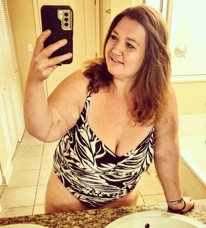 smrsala 136 kilograma i pala u komu3.png