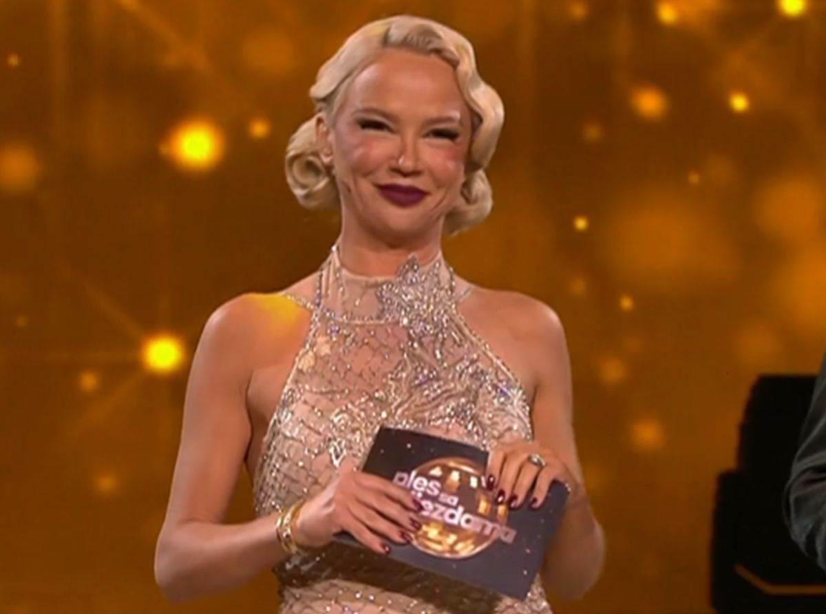 Maja Šuput ispeglano lice preterala s botoksom