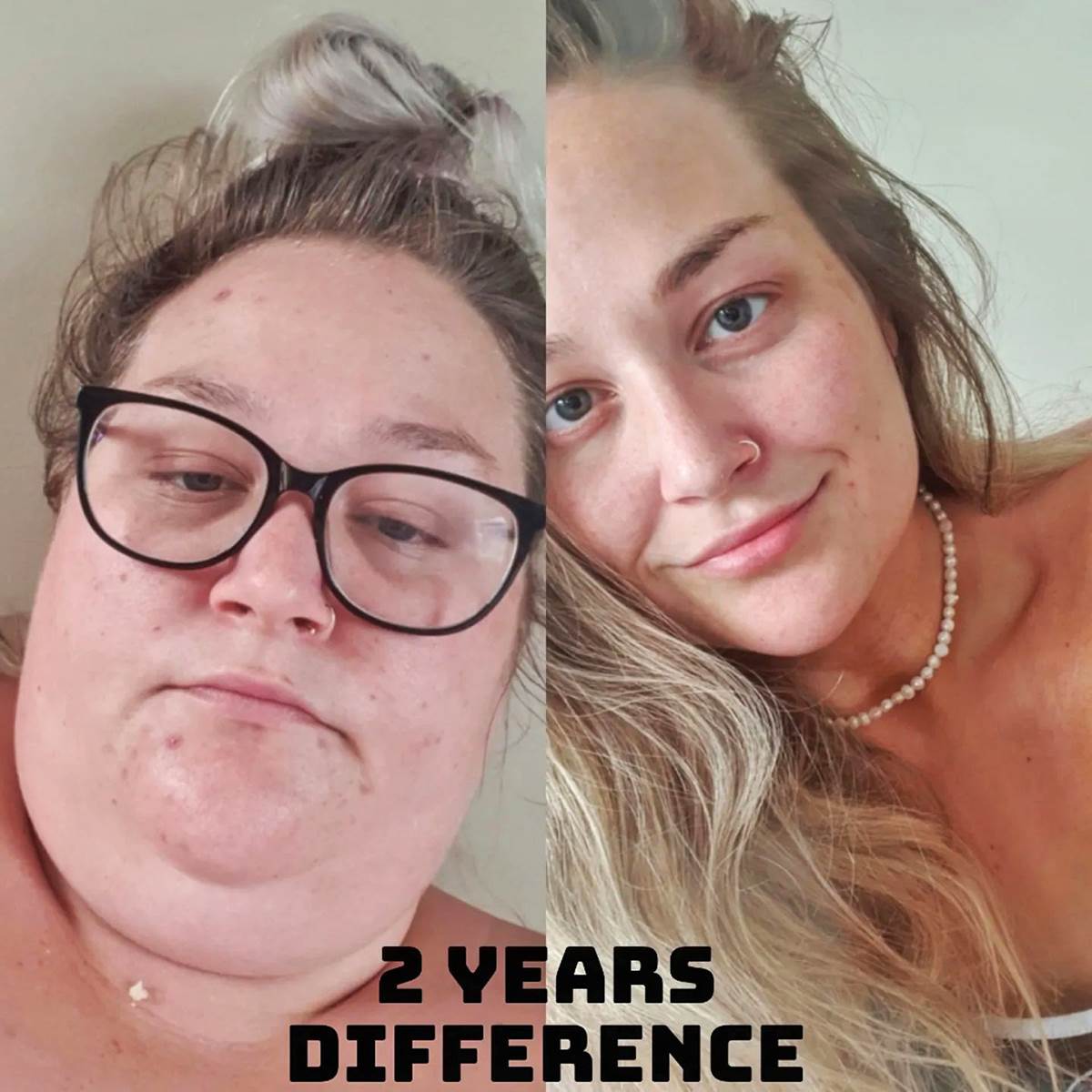 Mršavljenje PRE I POSLE (11).jpg