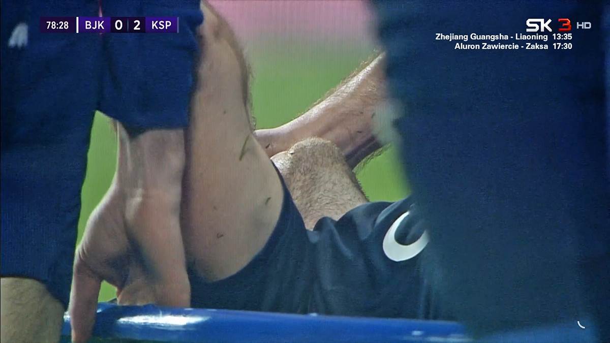 Uros Spajic povreda (1).png