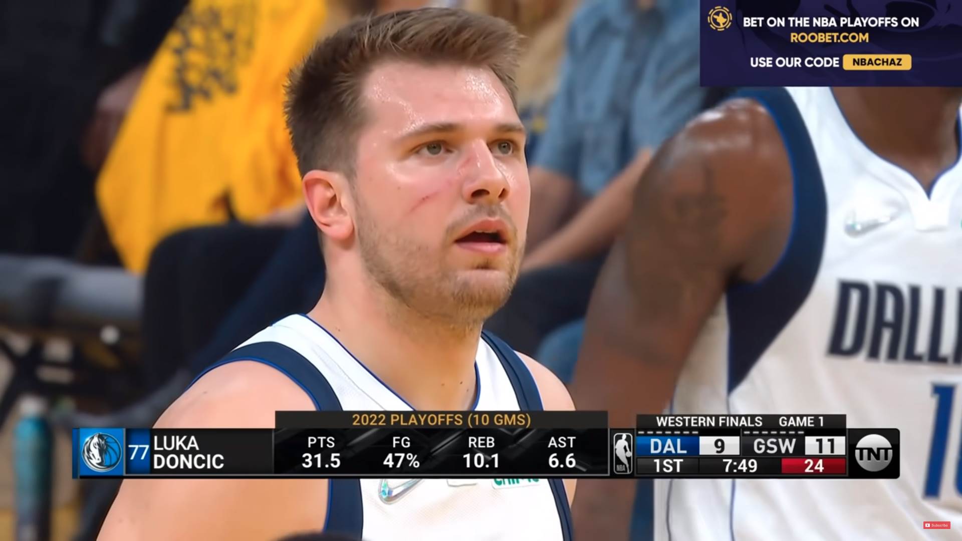 Luka Dončić ogrebotina na licu protiv Golden Stejta