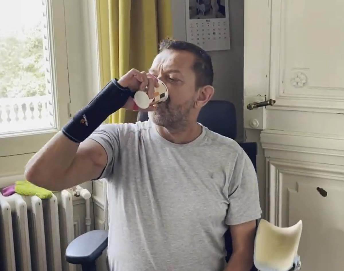 Čoveku presadili obe ruke