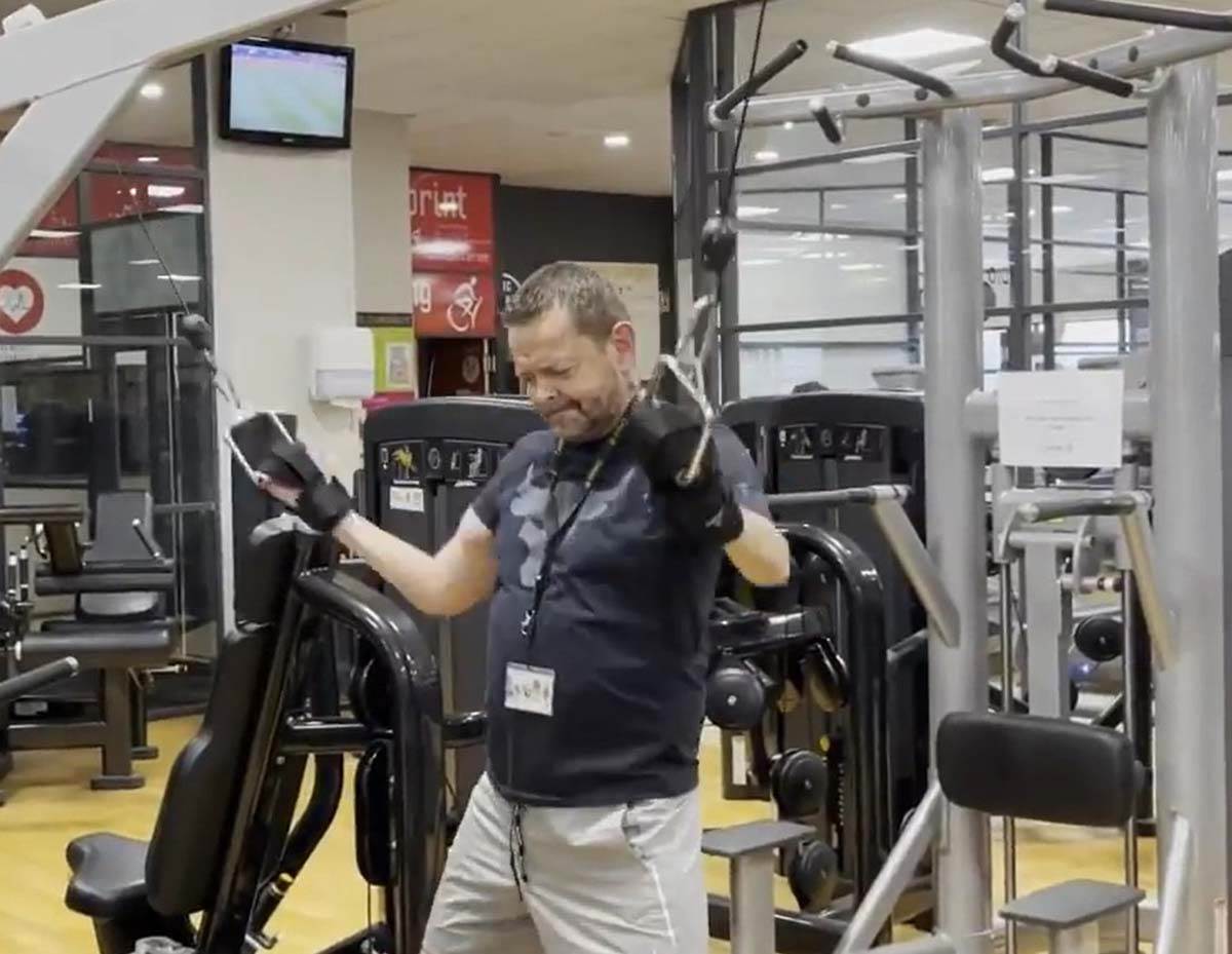 Čoveku presadili obe ruke