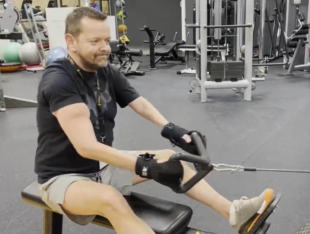 Čoveku presadili obe ruke