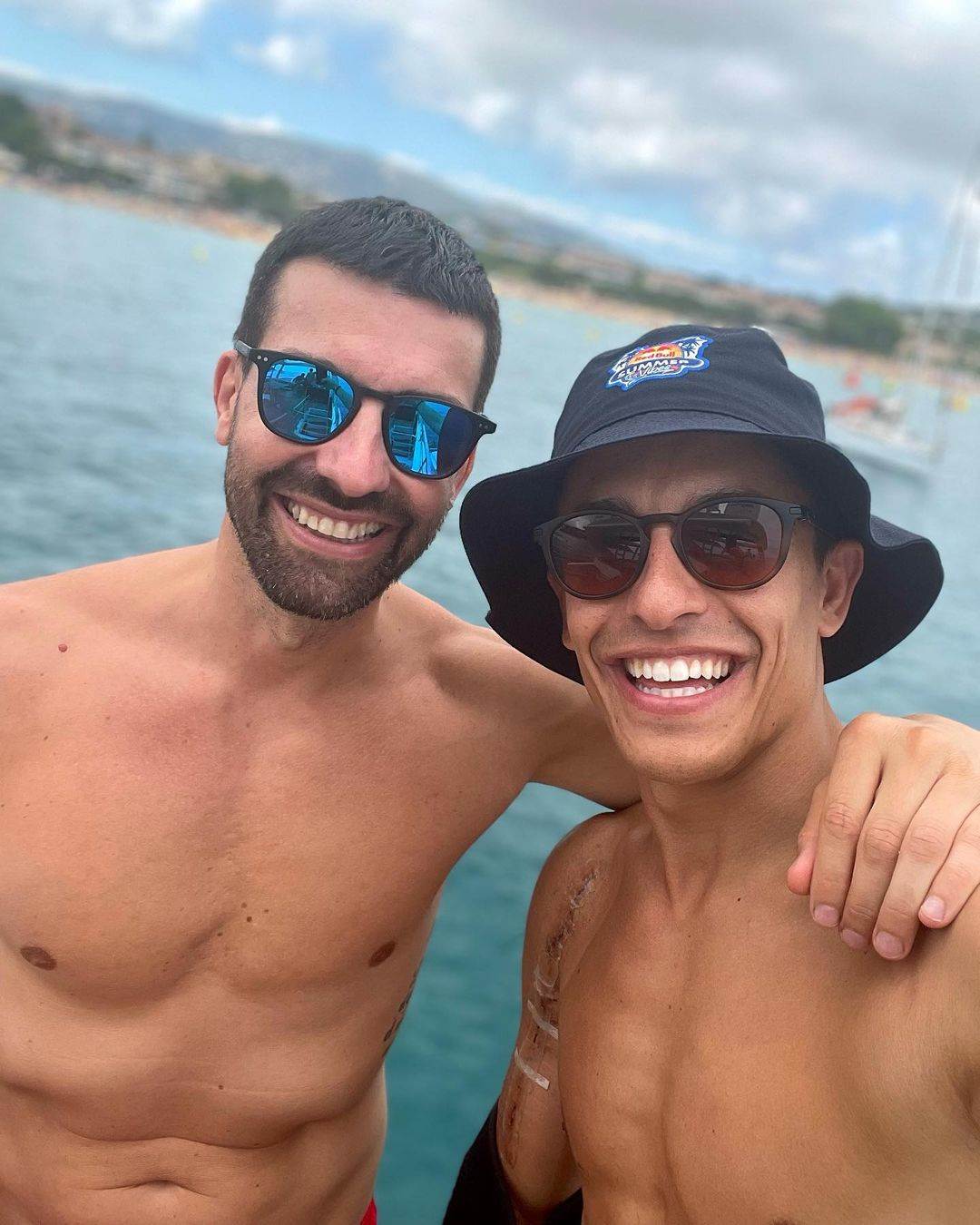 Mark Markez pokazao ožiljak nakon operacije