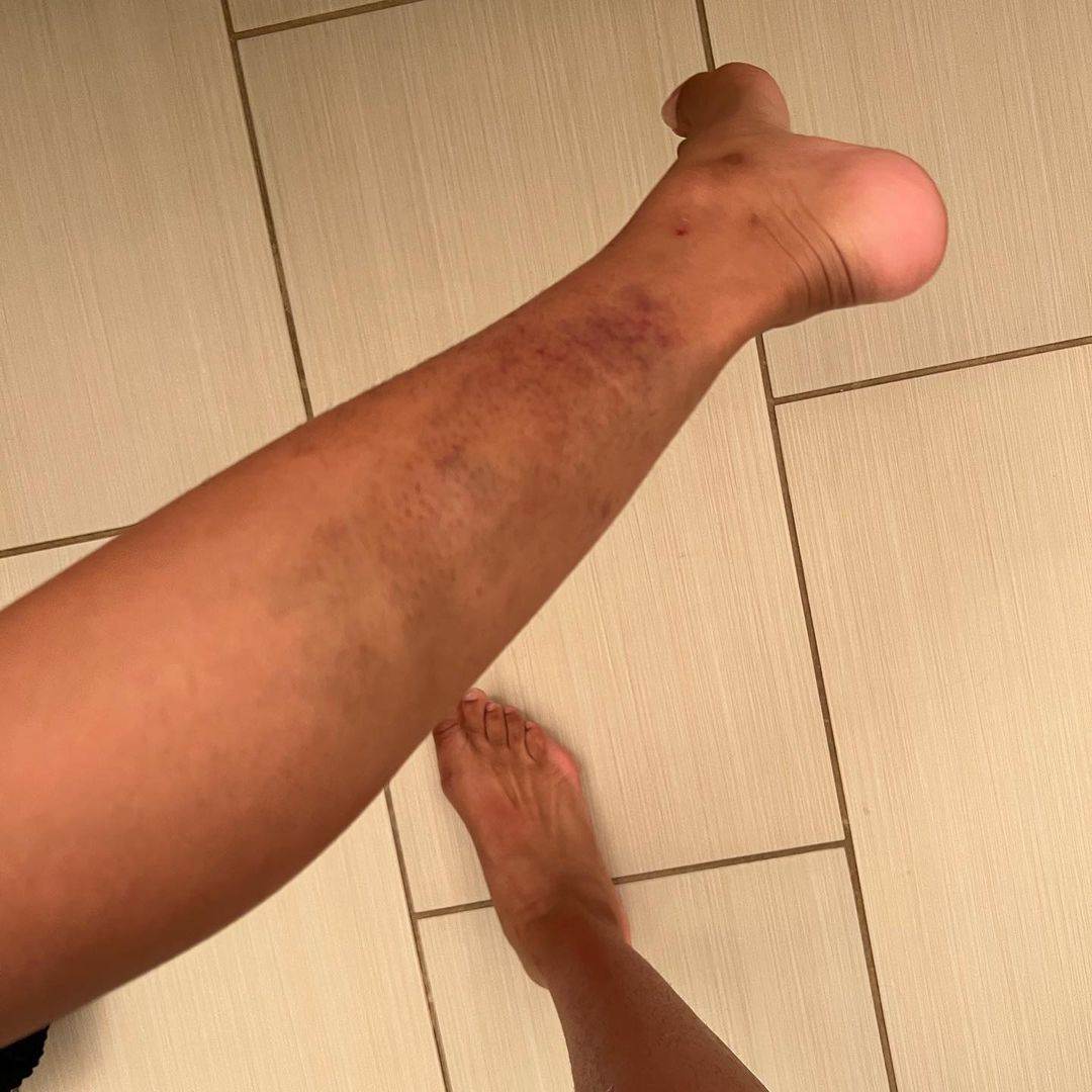 NBA košarkaš Majls Bridžis prekršio uslovnu