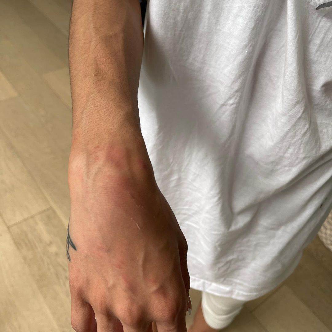 NBA košarkaš Majls Bridžis prekršio uslovnu