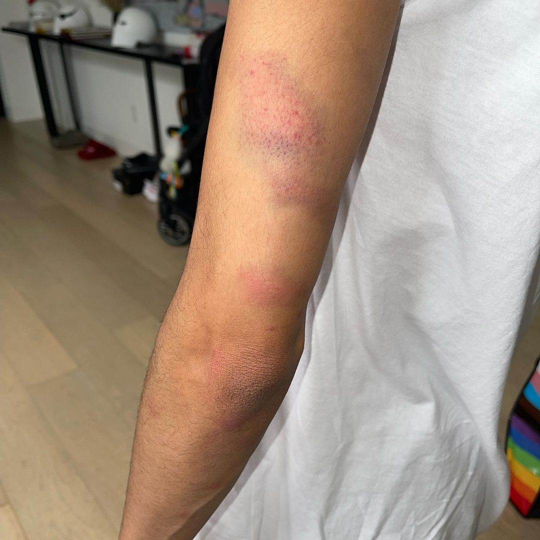 NBA košarkaš Majls Bridžis prekršio uslovnu