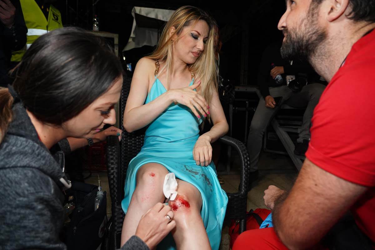 Rada Manojlović Povredila kolena  (6).jpg