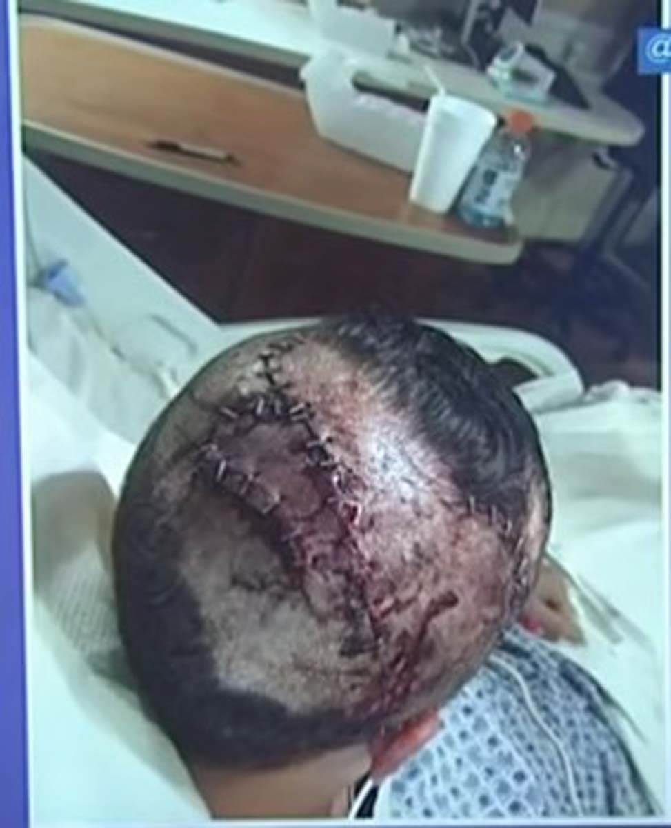 aligator napad 1.jpg