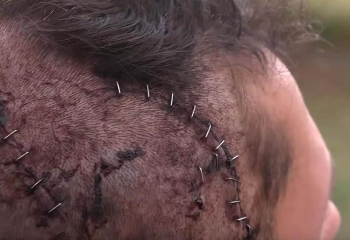 aligator napad 3.jpg