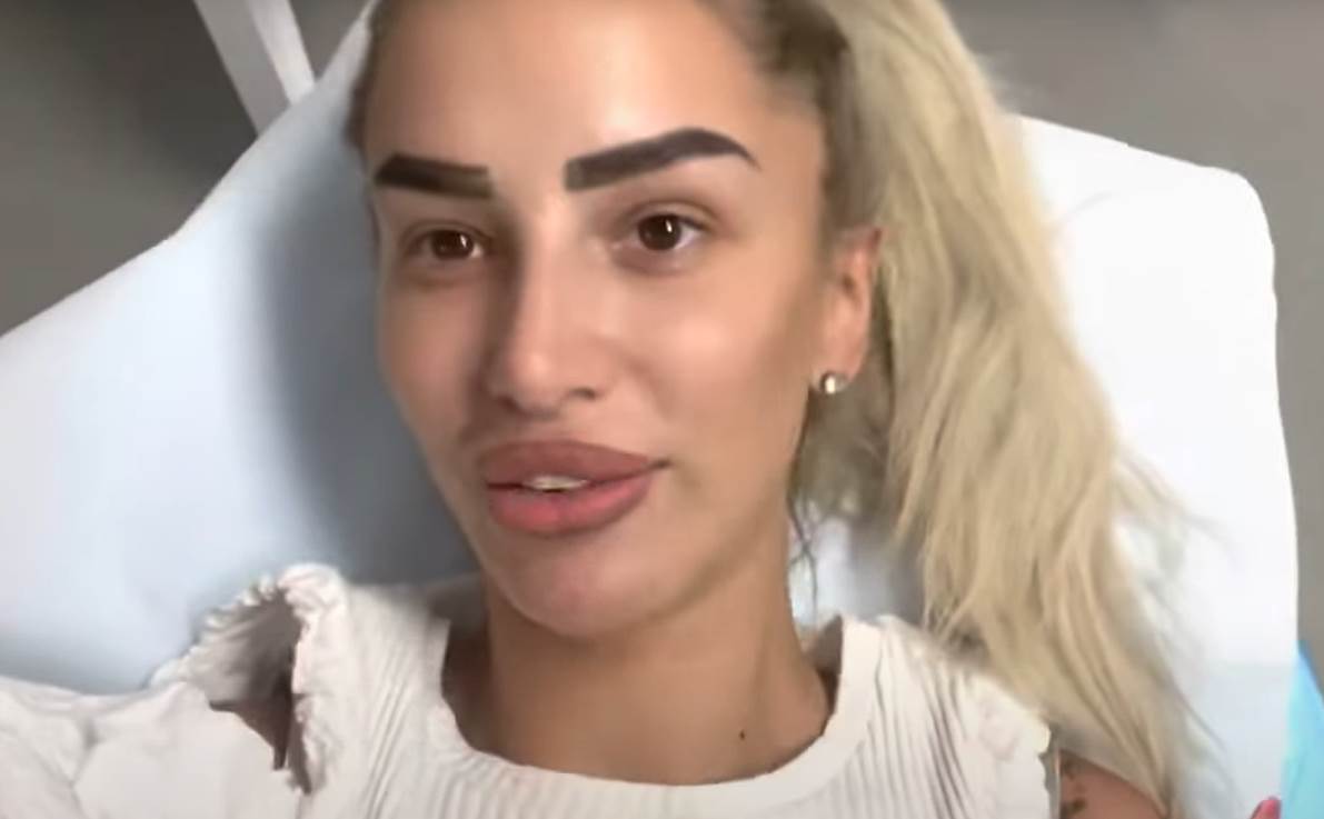 aleksandra nikolic vadila silikon iz usana (1).jpg