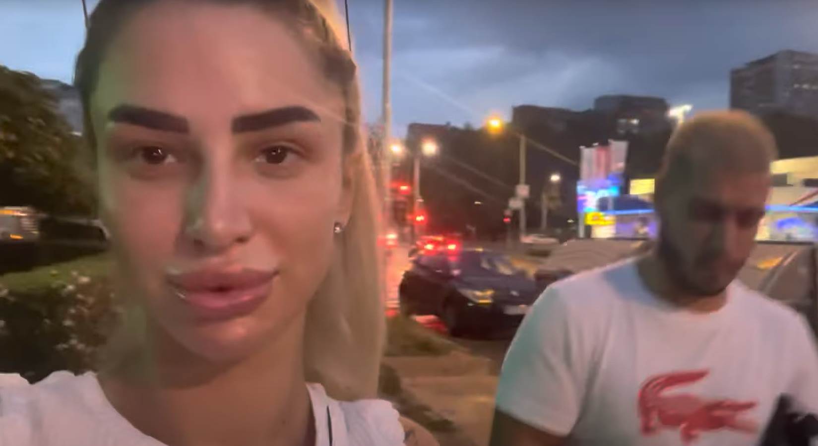 aleksandra nikolic vadila silikon iz usana (3).png