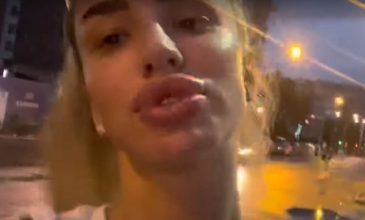 aleksandra nikolic vadila silikon iz usana (4).png