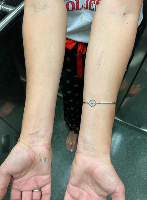 Komšije o tuči Severine i sestre