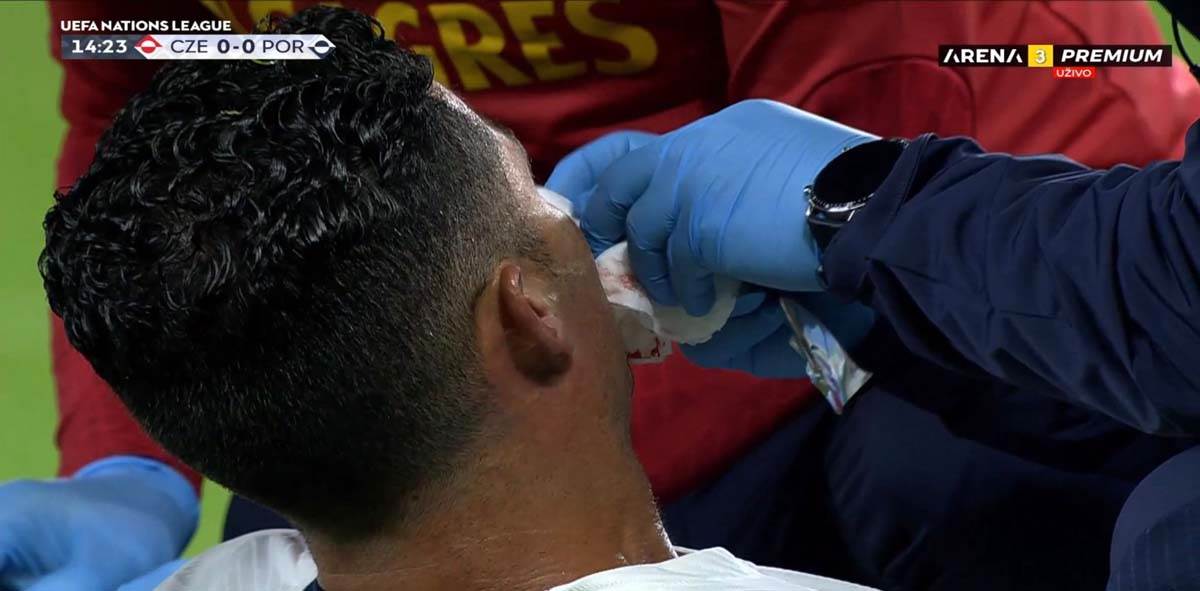 ‚Kristijano Ronaldo povreda  (7).jpg