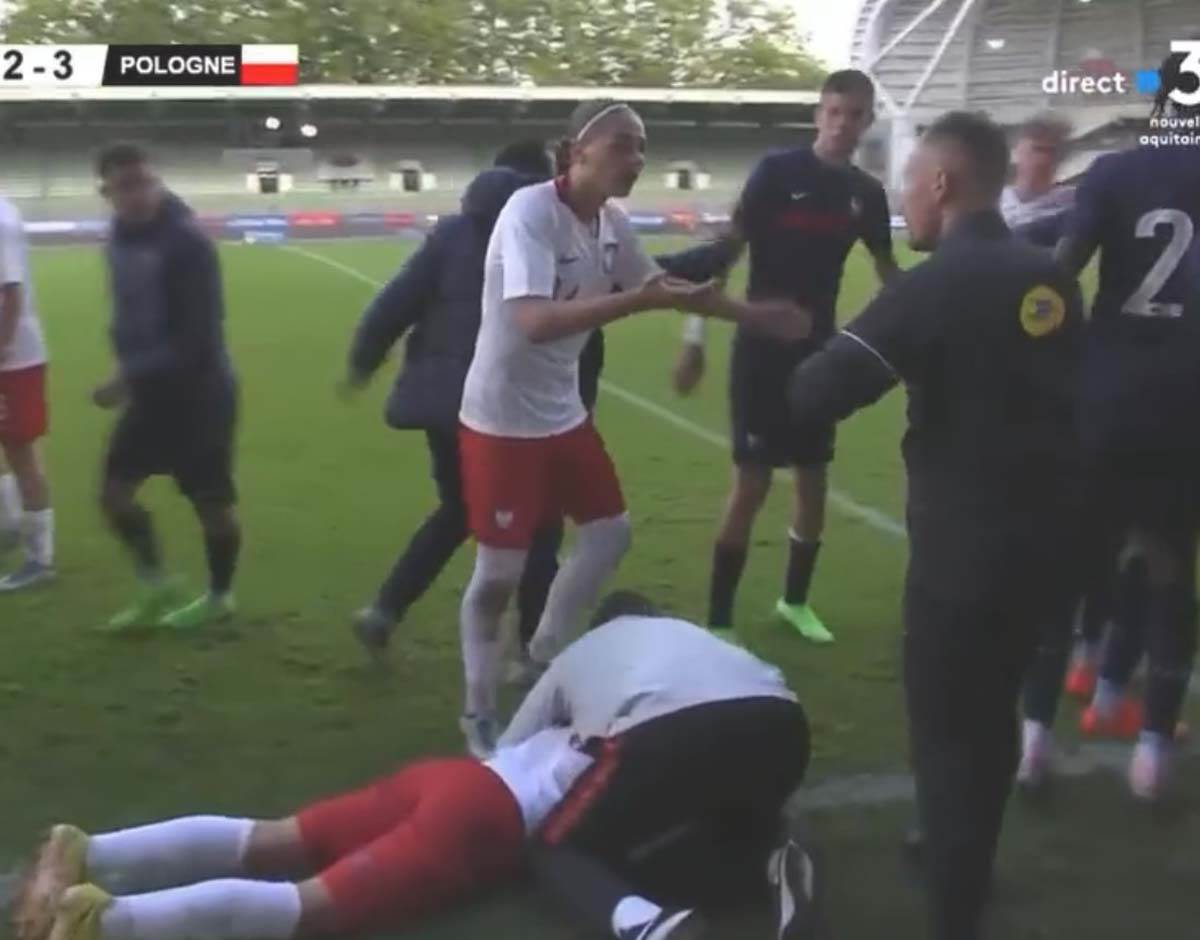 Francuska Poljska povreda  (1).jpg