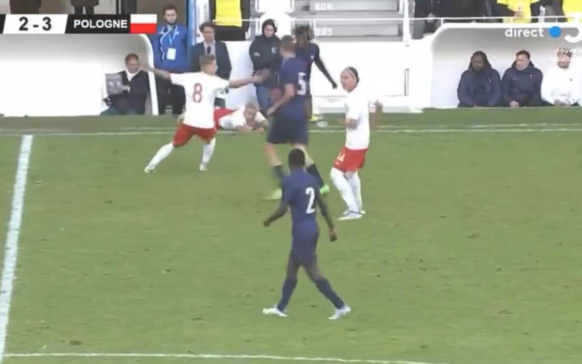 Francuska Poljska povreda  (4).jpg