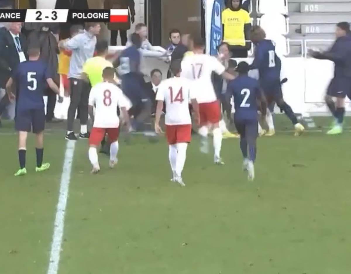 Francuska Poljska povreda  (5).jpg