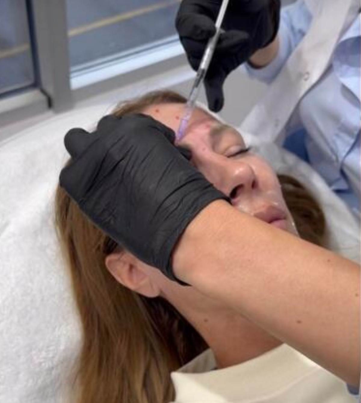 Vensa Đogani kod estetičara ubrizgala botoks