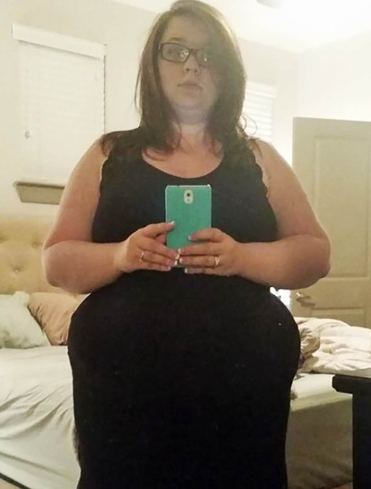 Transformacija devojke koja je imala 125 kg