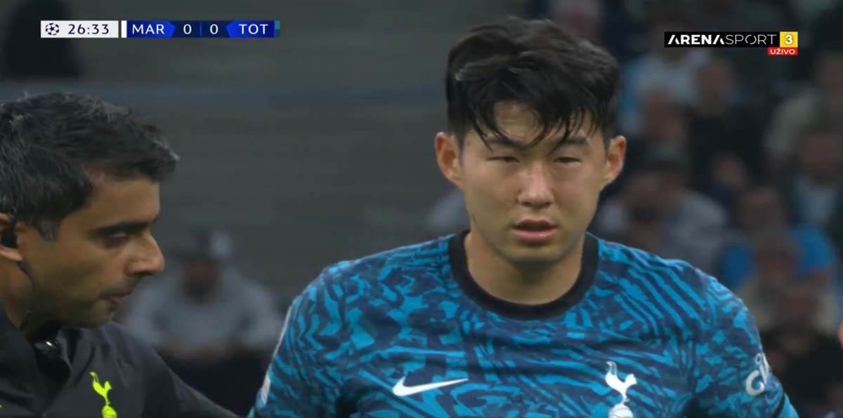 Hjung Min Son povreda  (7).jpg