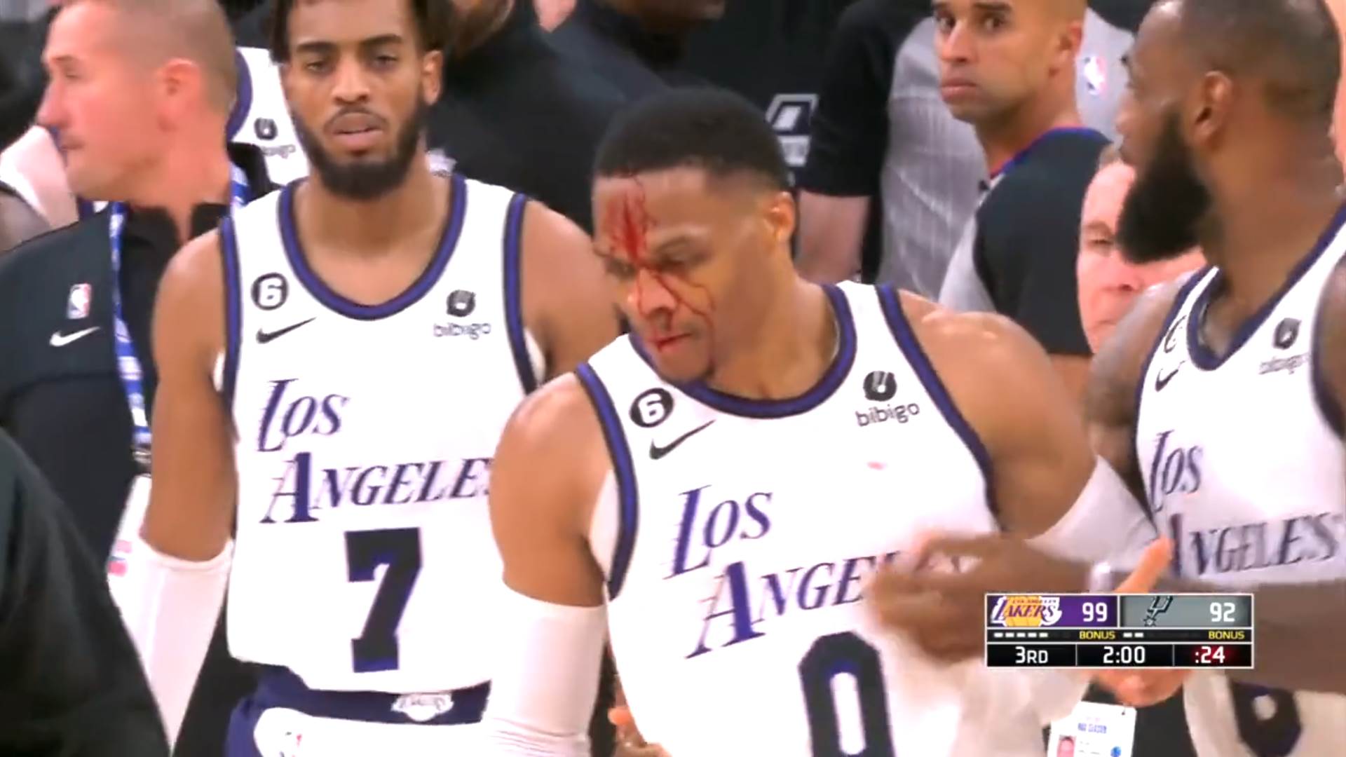 Raselu Vestbruku razbijena glava na meču NBA lige