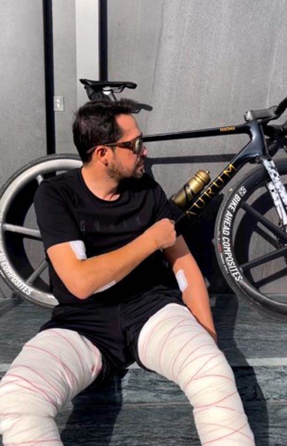 Albertu Kontadoru uklonjeno 100 tumora