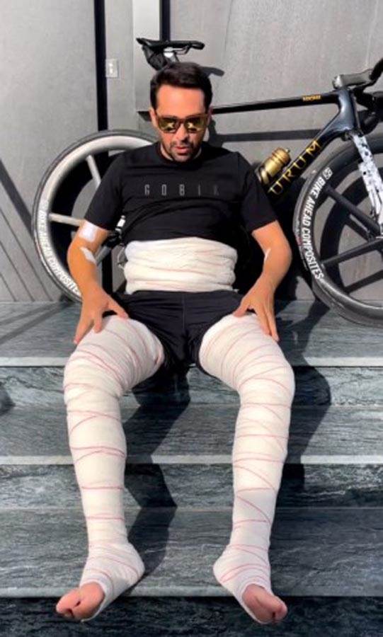 Albertu Kontadoru uklonjeno 100 tumora