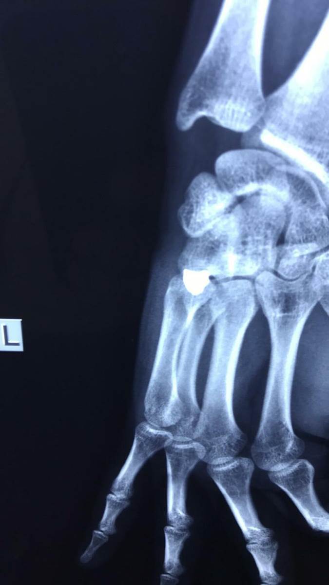 Pucanje mondo slika  (3).jpg