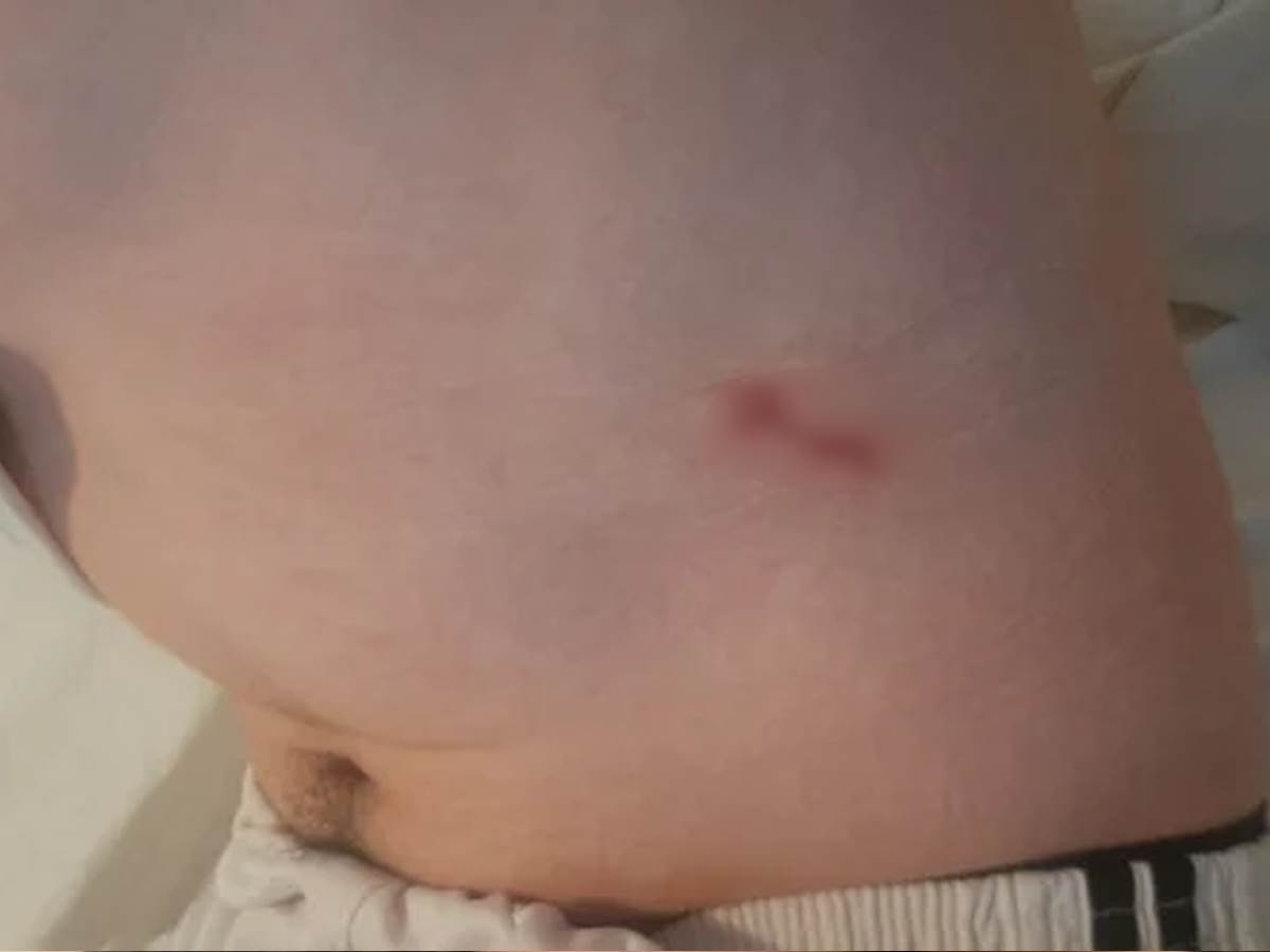 Pretučen srpski mladić na Kosovu 3.png