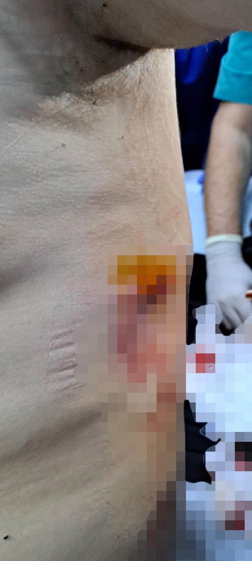 Oglasila se žena ranjenog muškarca na Kosovu