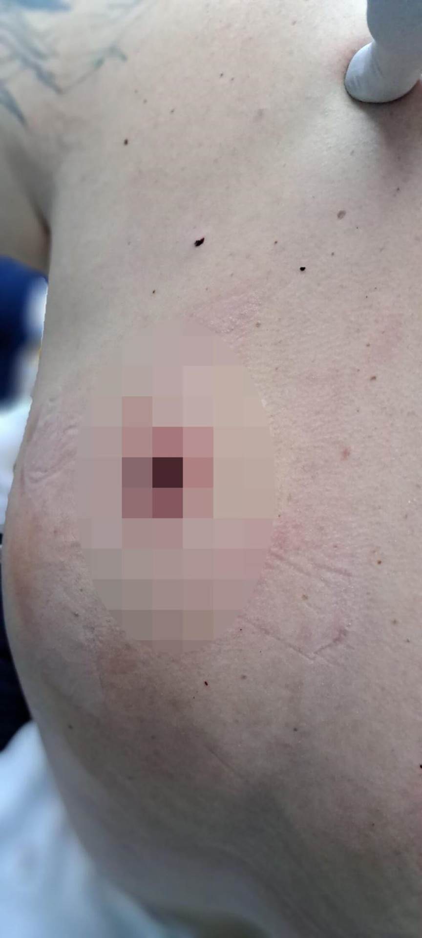 Oglasila se žena ranjenog muškarca na Kosovu