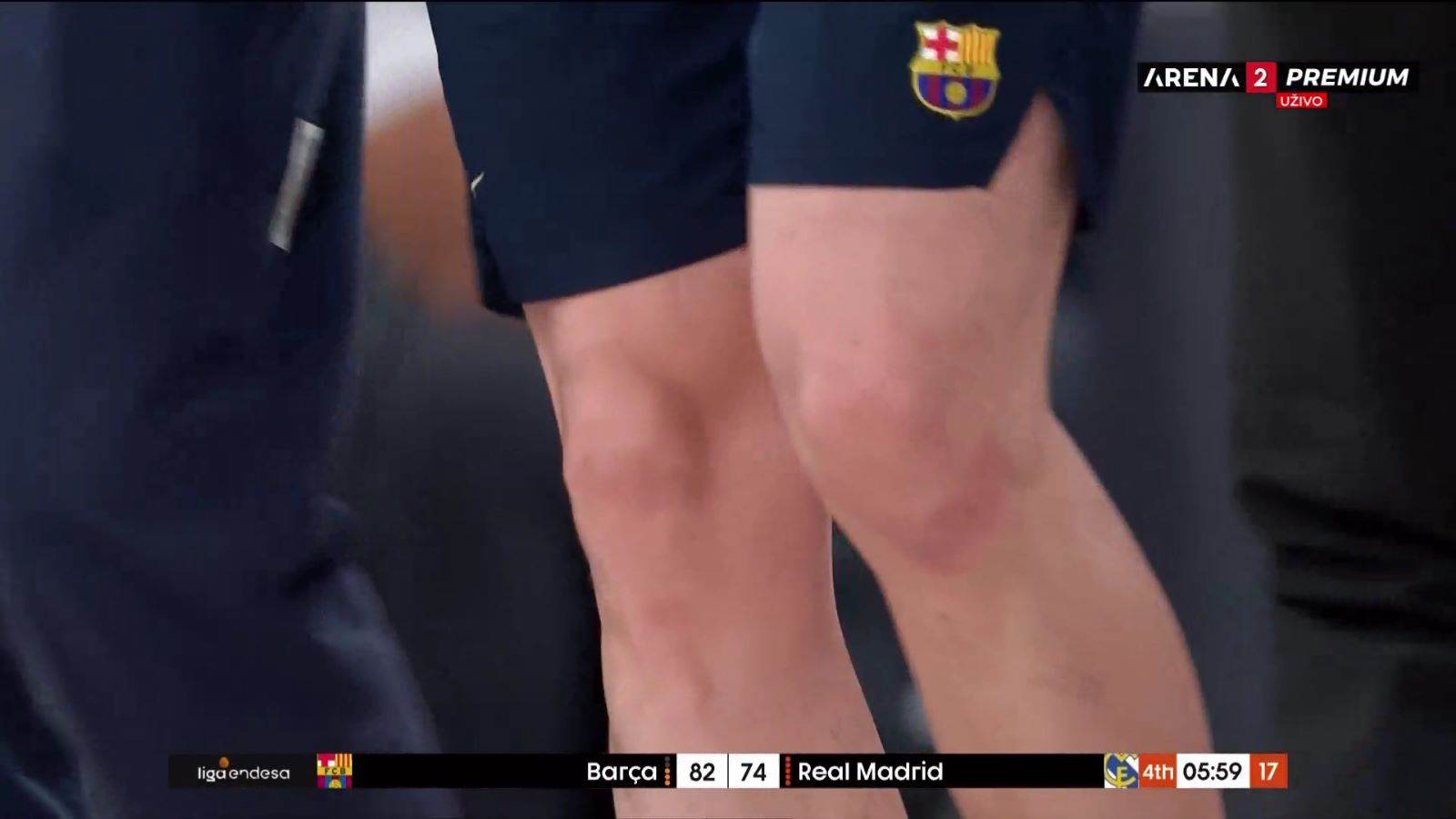 povreda Aleks Abrines na Barselona - Real Madrid (5).jpeg