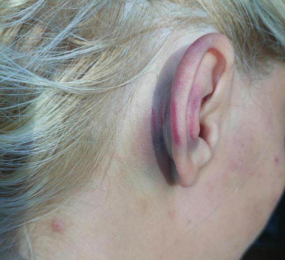 pretukao svoju suprugu.jpg