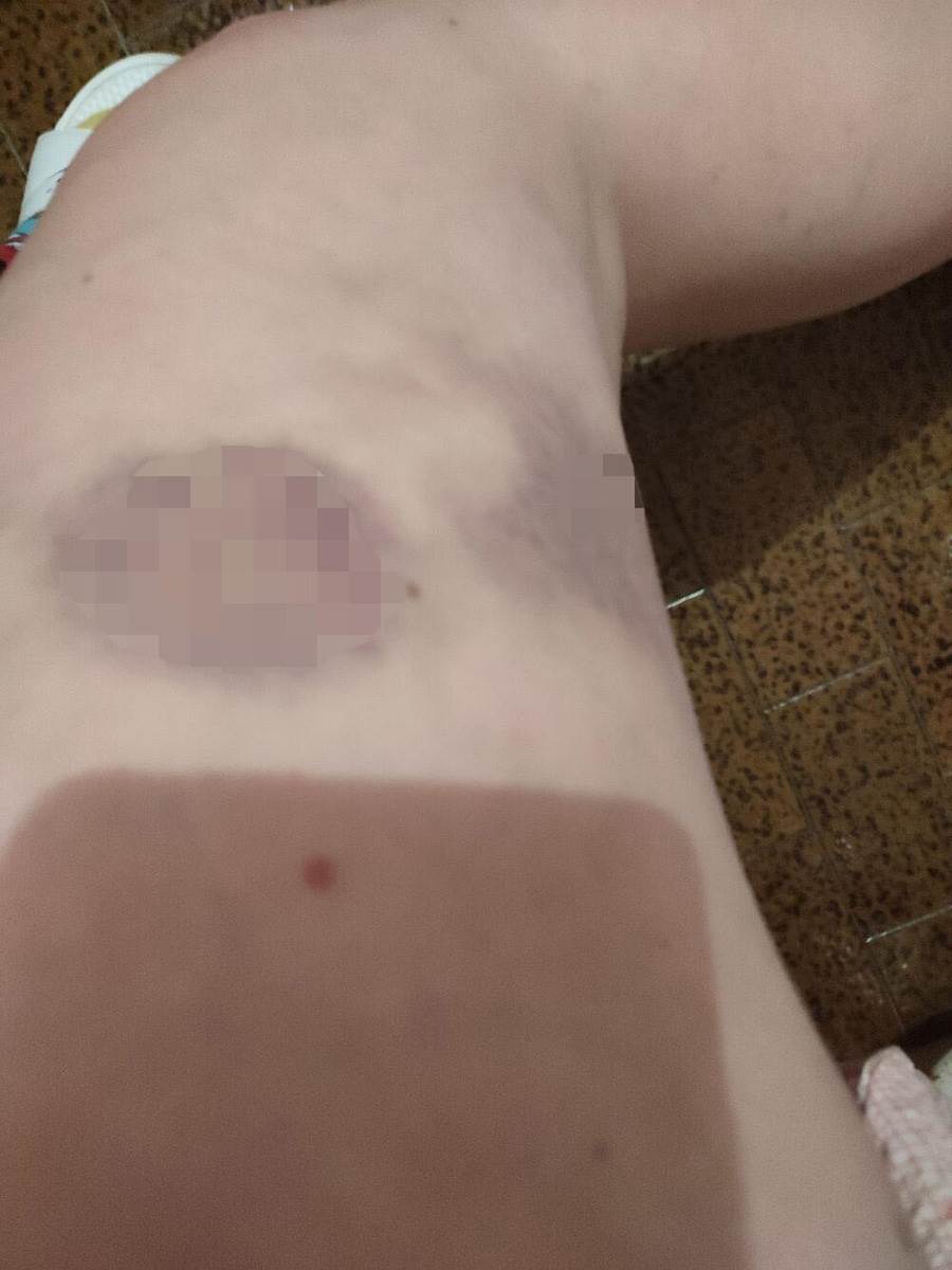 Žrtva nasilja  (3).jpg