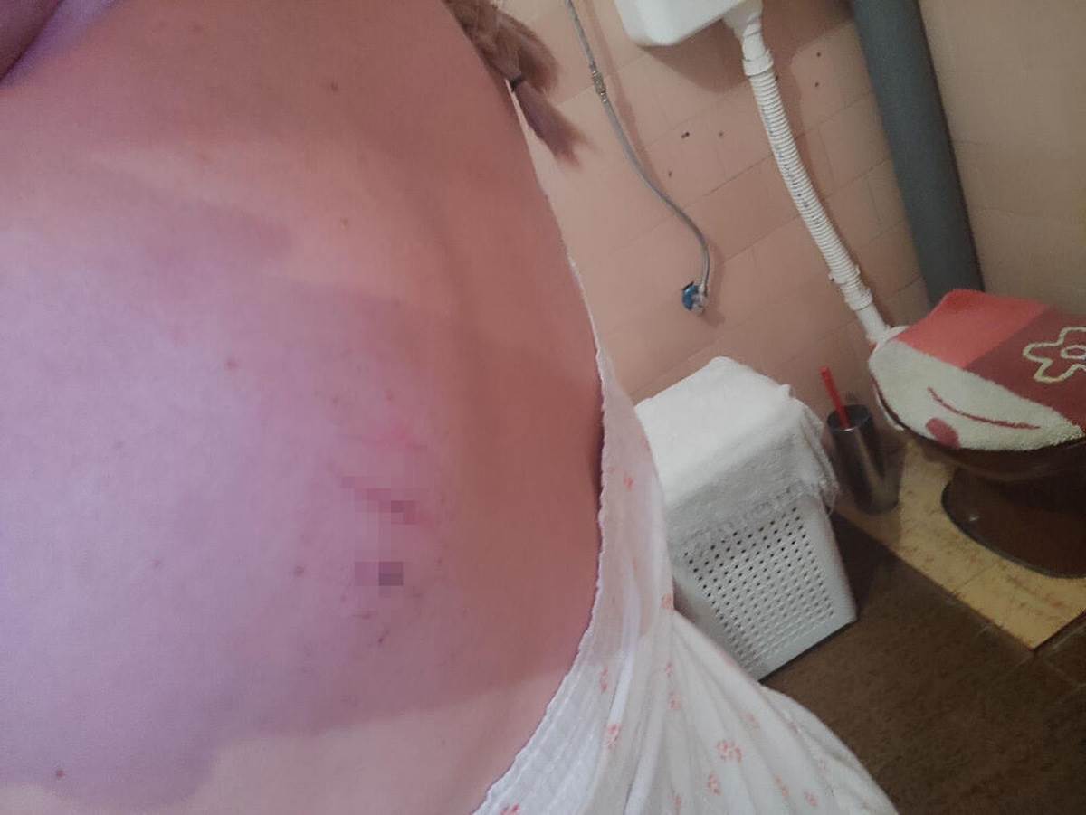 Žrtva nasilja  (4).jpg