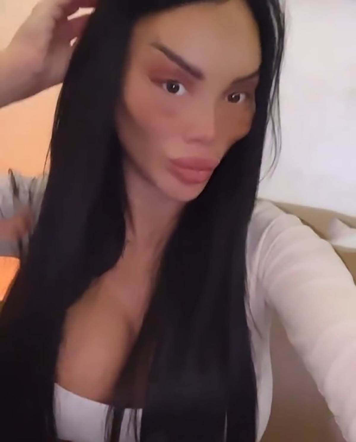 posle plastičnih operacija (5).jpg