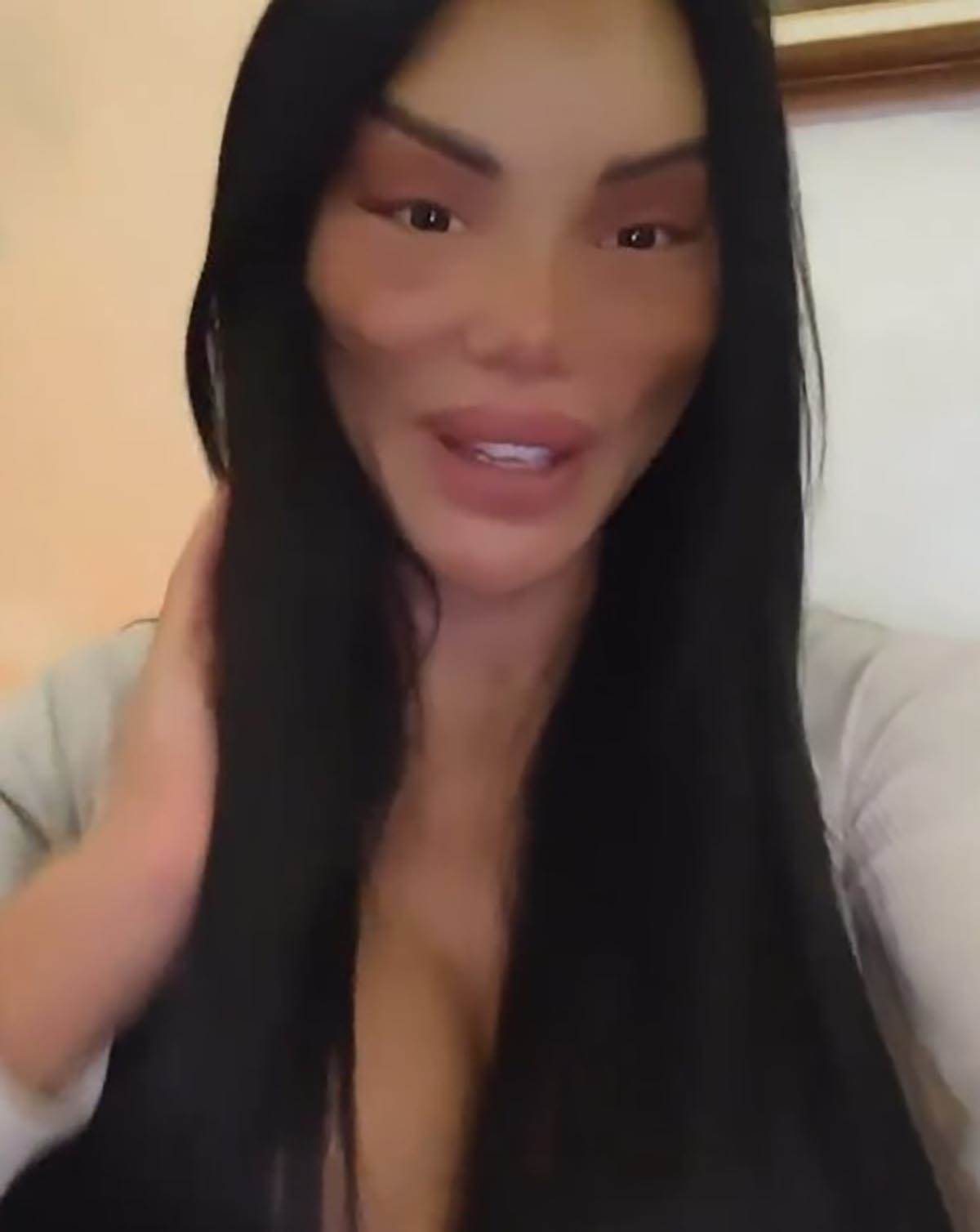 posle plastičnih operacija (6).jpg