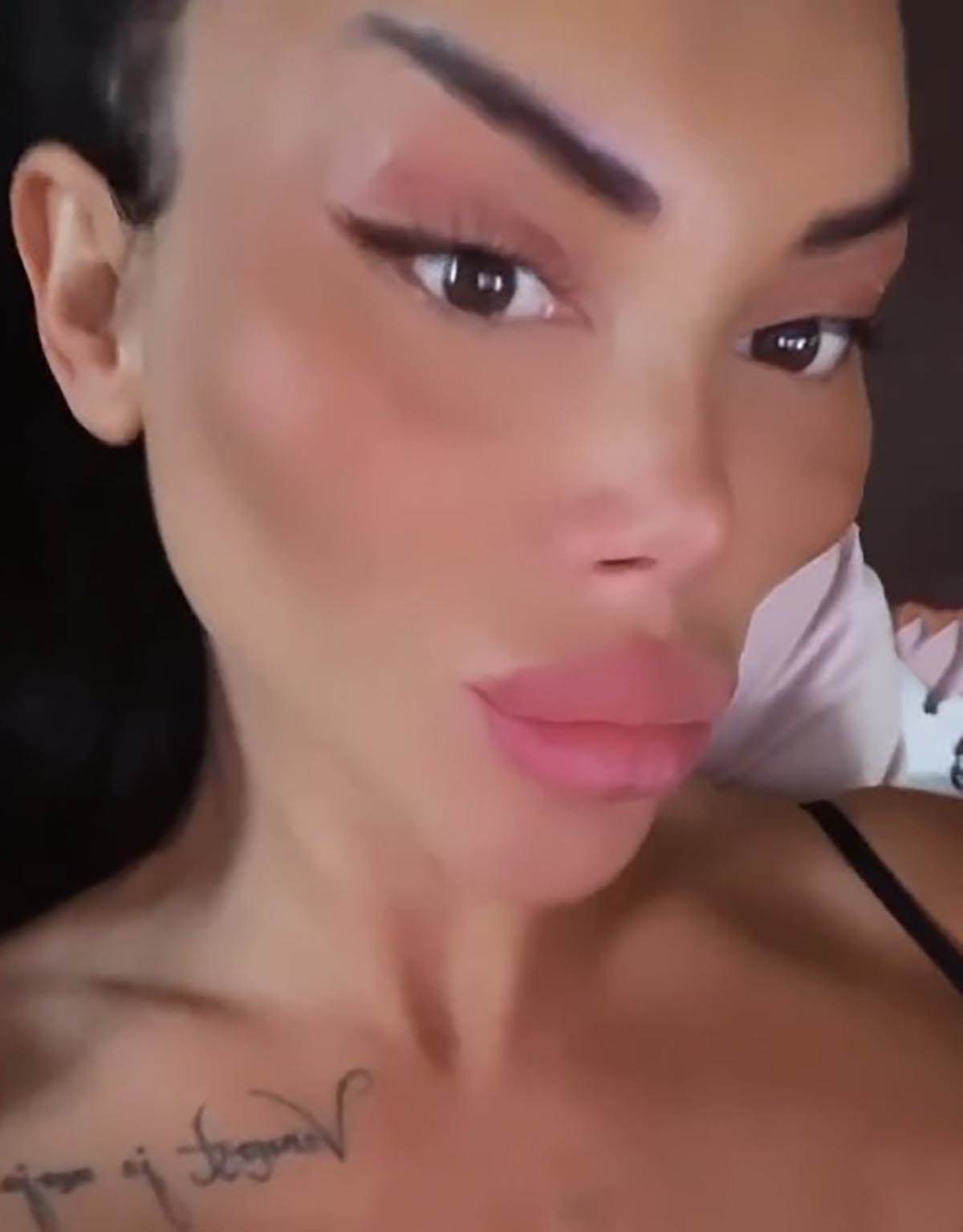 posle plastičnih operacija (7).jpg