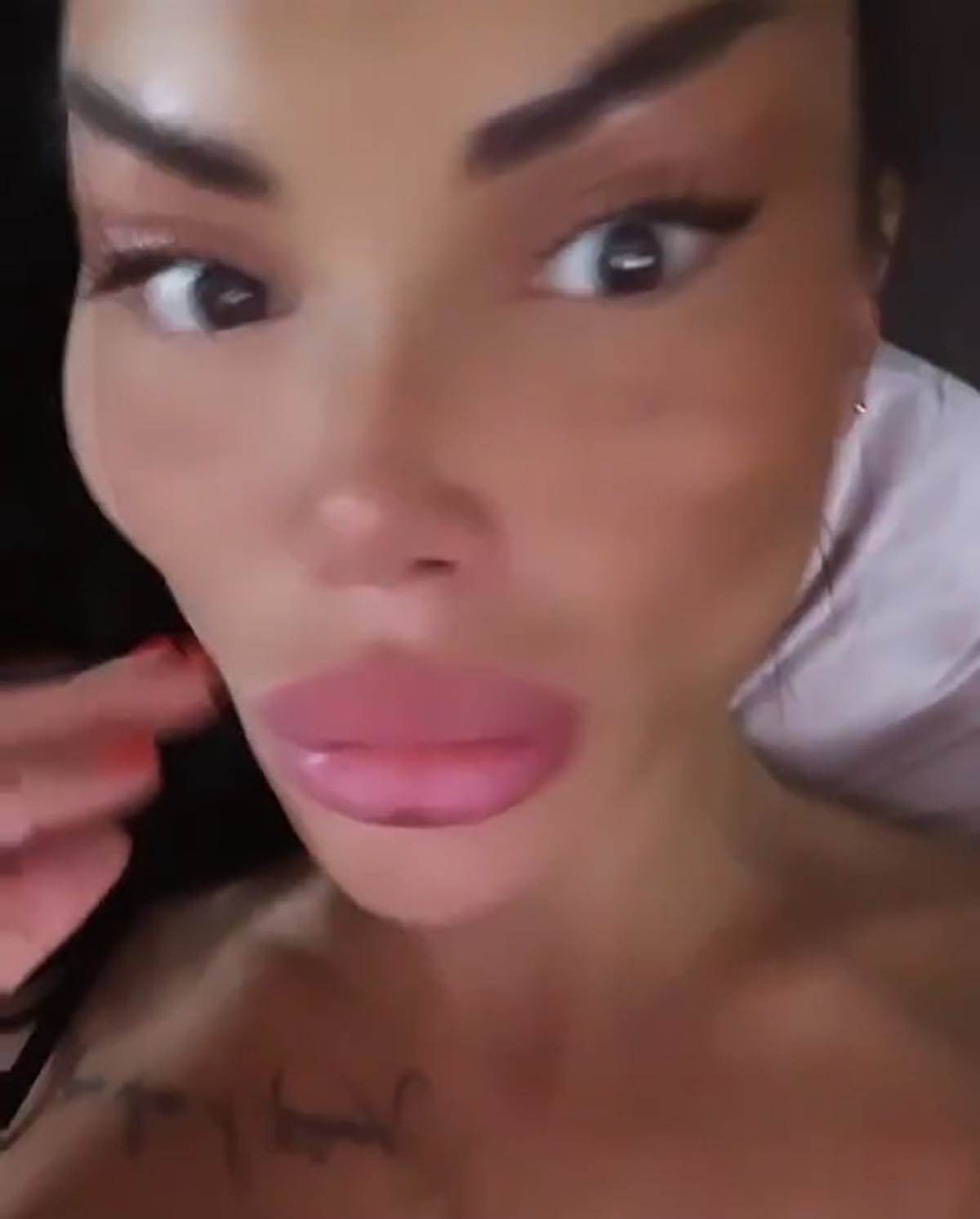 posle plastičnih operacija (8).jpg